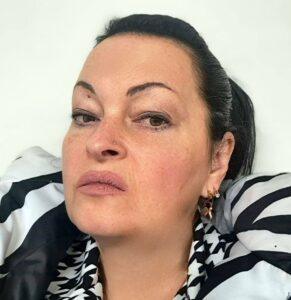 Rasa Mačiulytė, Alfonso