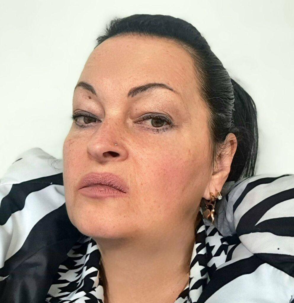 Rasa Mačiulytė, Alfonso